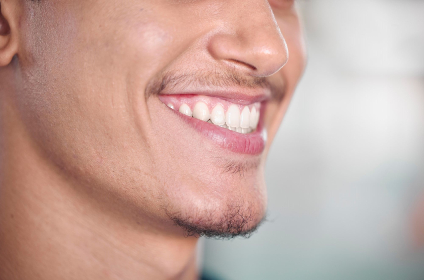 Mantener encías sanas Clínica dental en el Barrio del Pilar de Madrid